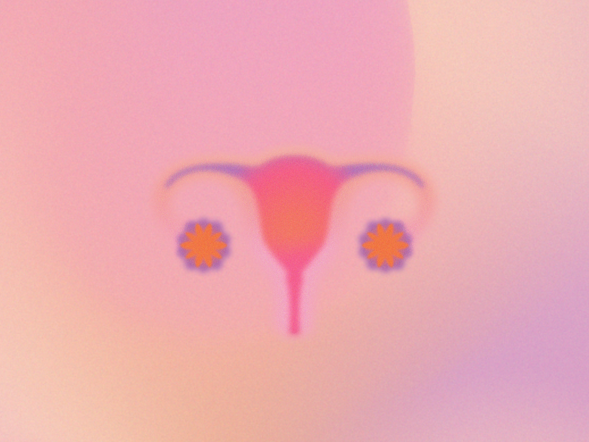 Jak wygląda endometrioza grafika macica pastelowe