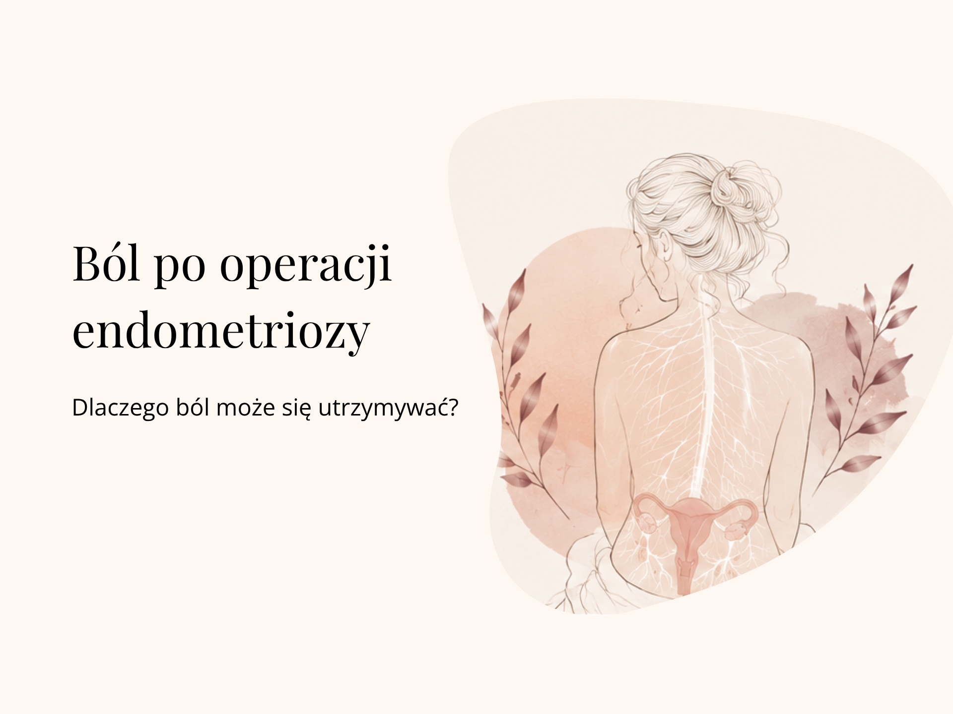 grafika bol po operacji endometriozy dlaczego bol moze sie utrzymywac